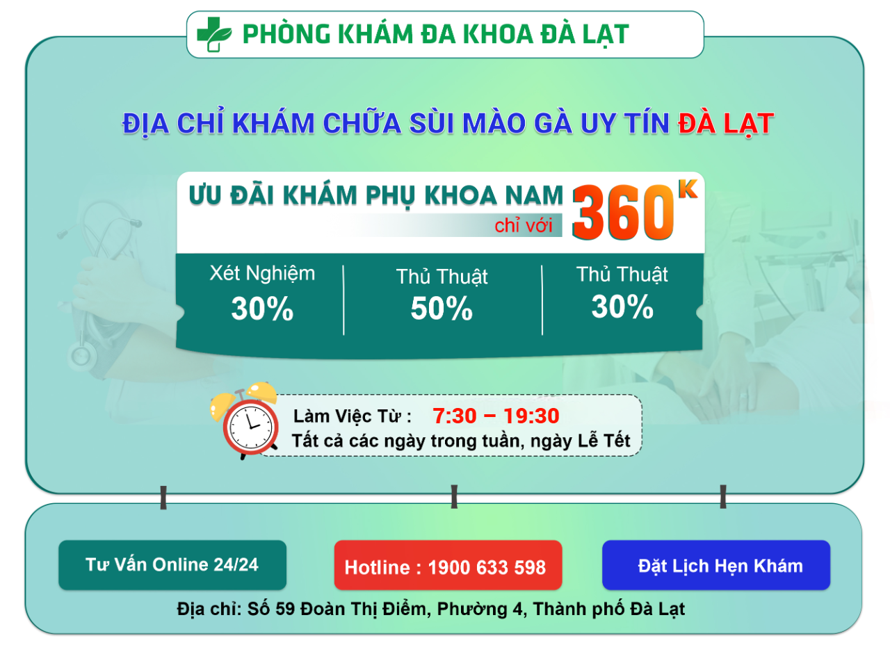 Hình ảnh minh họa